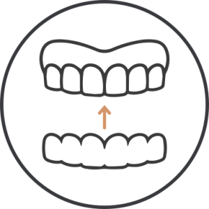 Invisalign Sydney 1