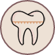 Clear Aligners