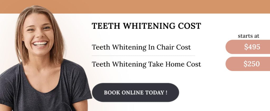 Teeth Whitening cost bella vista