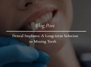 dental-Implant-bella-vista-1