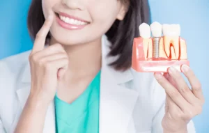 How to Heal Faster After Dental Implants Procedure